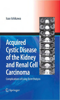 Acquired Cystic Disease of the Kidney and Renal Cell CarcinomaComplications of Long-Term Dialysis